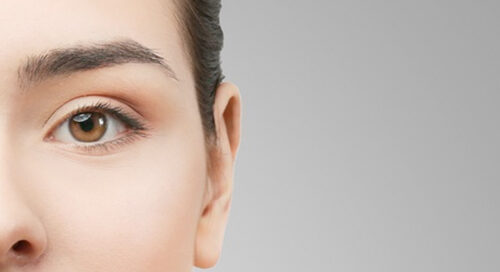 Lifting Sopracciglio