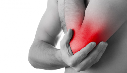 Sindrome del Nervo Ulnare